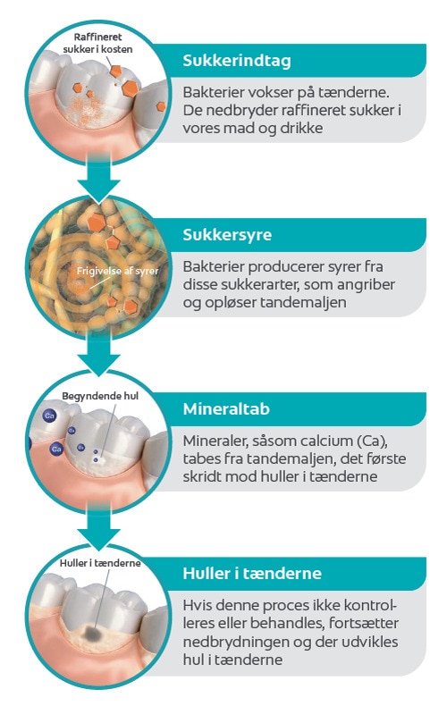Hvad forårsager huller i tænderne?