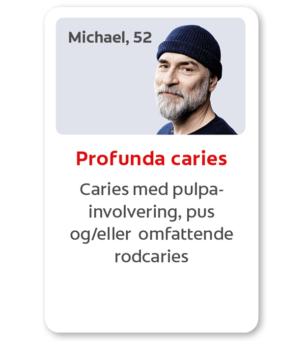 Caries med pulpa-involvering, pus og/eller omfattende rodcaries Caries med pulpa-involvering, pus og/eller omfattende rodcaries