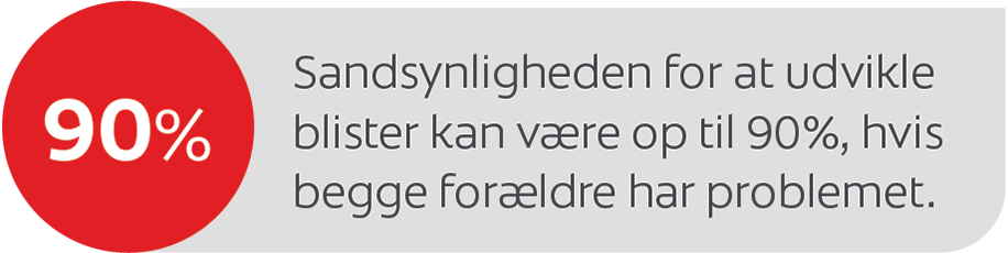 Sandsynligheden for at udvikle blister kan være op til 90%